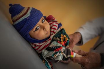 A child in a blue woolly hat and colourful jumper lies on a table. Their right arm is being measured by a doctor with a malnutrition wristband.